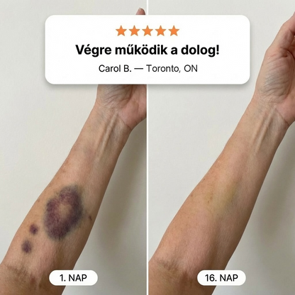 🎫100K+ ELADVA ✨😉 – CureVivo® Zúzódásjavító és bőrerősítő krém🔬