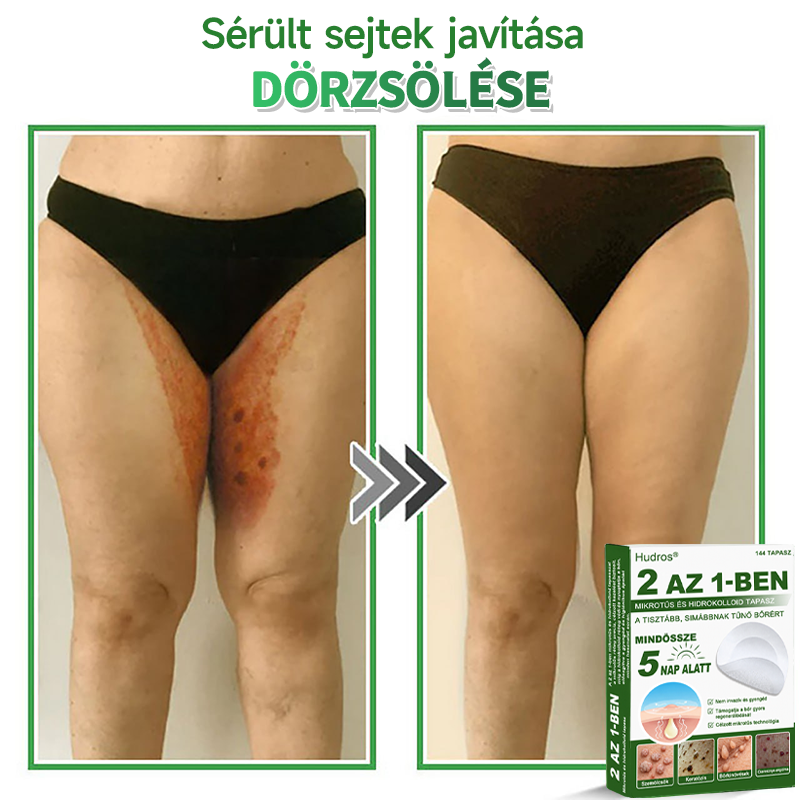 🌞Hudros® 2-az-1-ben Mikrotű & Hidrokoloid Tapasz 🇭🇺|👍Kiemelkedő Anyajegyek, Pattanások, Lapos Szemölcsök & Bőrkinövések Eltávolítója | Ráncok, Hegek & Bőrhibák Javítása | Láthatatlan Csillag Pattanástapasz Arcra & Testre | 144 db