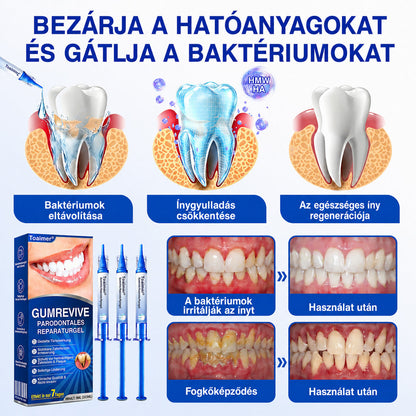 🩵🦷 Trilumia® 💗 GumRevive – fejlett gél az íny és a fogágy ápolására🇭🇺