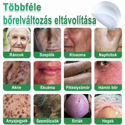 🌞Hudros® 2-az-1-ben Mikrotű & Hidrokoloid Tapasz 🇭🇺|👍Kiemelkedő Anyajegyek, Pattanások, Lapos Szemölcsök & Bőrkinövések Eltávolítója | Ráncok, Hegek & Bőrhibák Javítása | Láthatatlan Csillag Pattanástapasz Arcra & Testre | 144 db