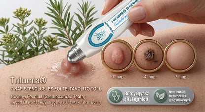🚩𝑻𝒓𝒊𝒍𝒖𝒎𝒊𝒂® 🐠🥏Prémium roller toll | Szőrtüskék, anyajegyek és foltok eltávolítására