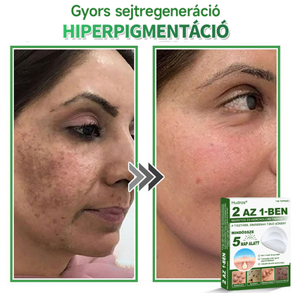 🌞Hudros® 2-az-1-ben Mikrotű & Hidrokoloid Tapasz 🇭🇺|👍Kiemelkedő Anyajegyek, Pattanások, Lapos Szemölcsök & Bőrkinövések Eltávolítója | Ráncok, Hegek & Bőrhibák Javítása | Láthatatlan Csillag Pattanástapasz Arcra & Testre | 144 db