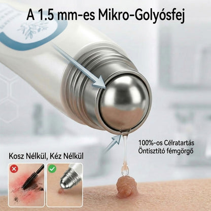 🚩𝑻𝒓𝒊𝒍𝒖𝒎𝒊𝒂® 🐠🥏Prémium roller toll | Szőrtüskék, anyajegyek és foltok eltávolítására