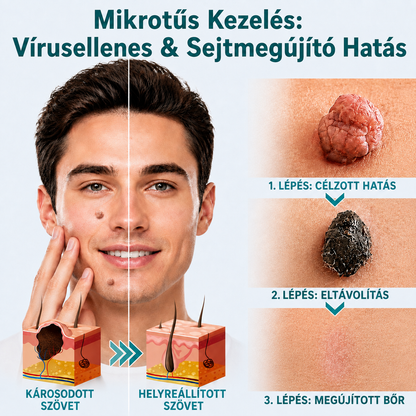 🎉🇭🇺 Healrize® 2 az 1-ben mikrotűs + hidrokolloid tapasz 💫 | Anyajegy, pattanás, lapos szemölcs és bőrkinövés ápolására | Ráncok, hegek és bőrhibák megjelenésének javítására | Láthatatlan tapasz arcra és testre
