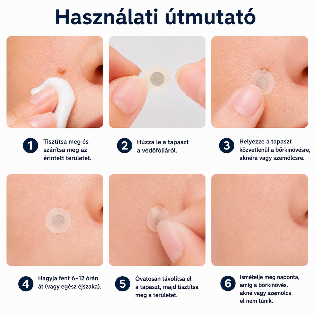 🎉🇭🇺 Healrize® 2 az 1-ben mikrotűs + hidrokolloid tapasz 💫 | Anyajegy, pattanás, lapos szemölcs és bőrkinövés ápolására | Ráncok, hegek és bőrhibák megjelenésének javítására | Láthatatlan tapasz arcra és testre