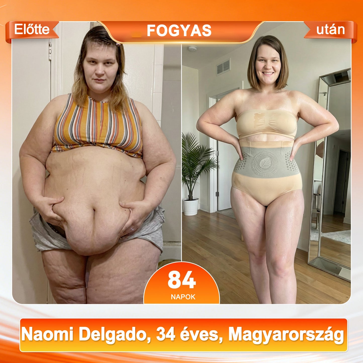 🇭🇺 Hivatalos Márkabolt |💎BQODQO®✅2026-os Moringa & Berberin 4-az-1-ben Mikrorészecskés Alakformáló és Zsírégető Rövidnadrág