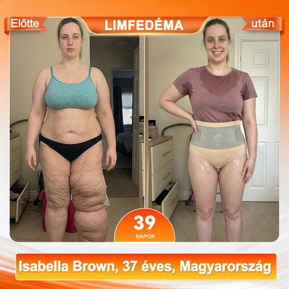 🇭🇺 Hivatalos Márkabolt |💎BQODQO®✅2026-os Moringa & Berberin 4-az-1-ben Mikrorészecskés Alakformáló és Zsírégető Rövidnadrág