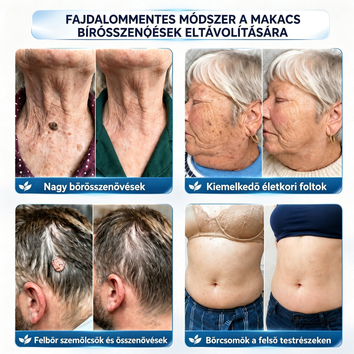 🏆𝗖𝘂𝗿𝗲𝗩𝗶𝘃𝗼® 𝟕-𝐍𝐚𝐩𝐨𝐬 𝐁ő𝐫𝐜í𝐦𝐤é𝐤 é𝐬 𝐅𝐨𝐥𝐭𝐨𝐤 𝐄𝐥𝐭á𝐯𝐨𝐥í𝐭ó 𝐊𝐫é𝐦 (𝐅á𝐣𝐝𝐚𝐥𝐨𝐦𝐦𝐞𝐧𝐭𝐞𝐬 𝐅𝐨𝐫𝐦𝐮𝐥𝐚 – 𝐇𝐞𝐠𝐞𝐤 𝐍é𝐥𝐤ü𝐥)
