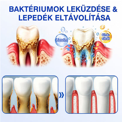 🩵🦷 Trilumia® 💗 GumRevive – fejlett gél az íny és a fogágy ápolására🇭🇺