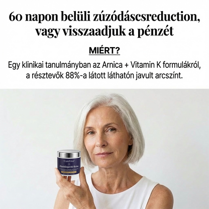 🎫100K+ ELADVA ✨😉 – CureVivo® Zúzódásjavító és bőrerősítő krém🔬
