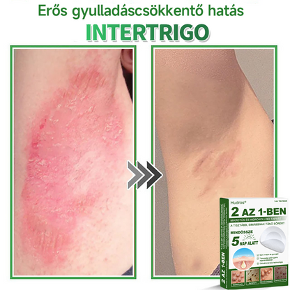 🌞Hudros® 2-az-1-ben Mikrotű & Hidrokoloid Tapasz 🇭🇺|👍Kiemelkedő Anyajegyek, Pattanások, Lapos Szemölcsök & Bőrkinövések Eltávolítója | Ráncok, Hegek & Bőrhibák Javítása | Láthatatlan Csillag Pattanástapasz Arcra & Testre | 144 db