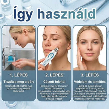 🚩𝑻𝒓𝒊𝒍𝒖𝒎𝒊𝒂® 🐠🥏Prémium roller toll | Szőrtüskék, anyajegyek és foltok eltávolítására