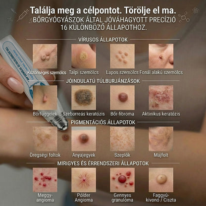 🚩𝑻𝒓𝒊𝒍𝒖𝒎𝒊𝒂® 🐠🥏Prémium roller toll | Szőrtüskék, anyajegyek és foltok eltávolítására