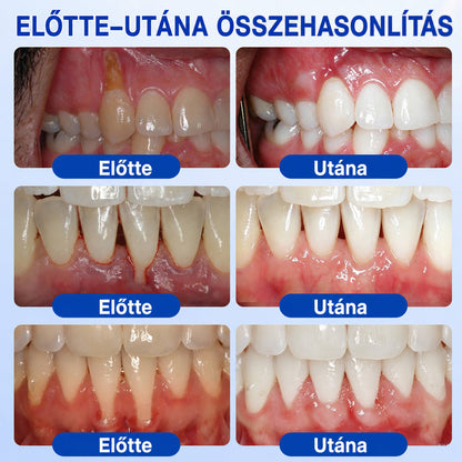 🩵🦷 Trilumia® 💗 GumRevive – fejlett gél az íny és a fogágy ápolására🇭🇺