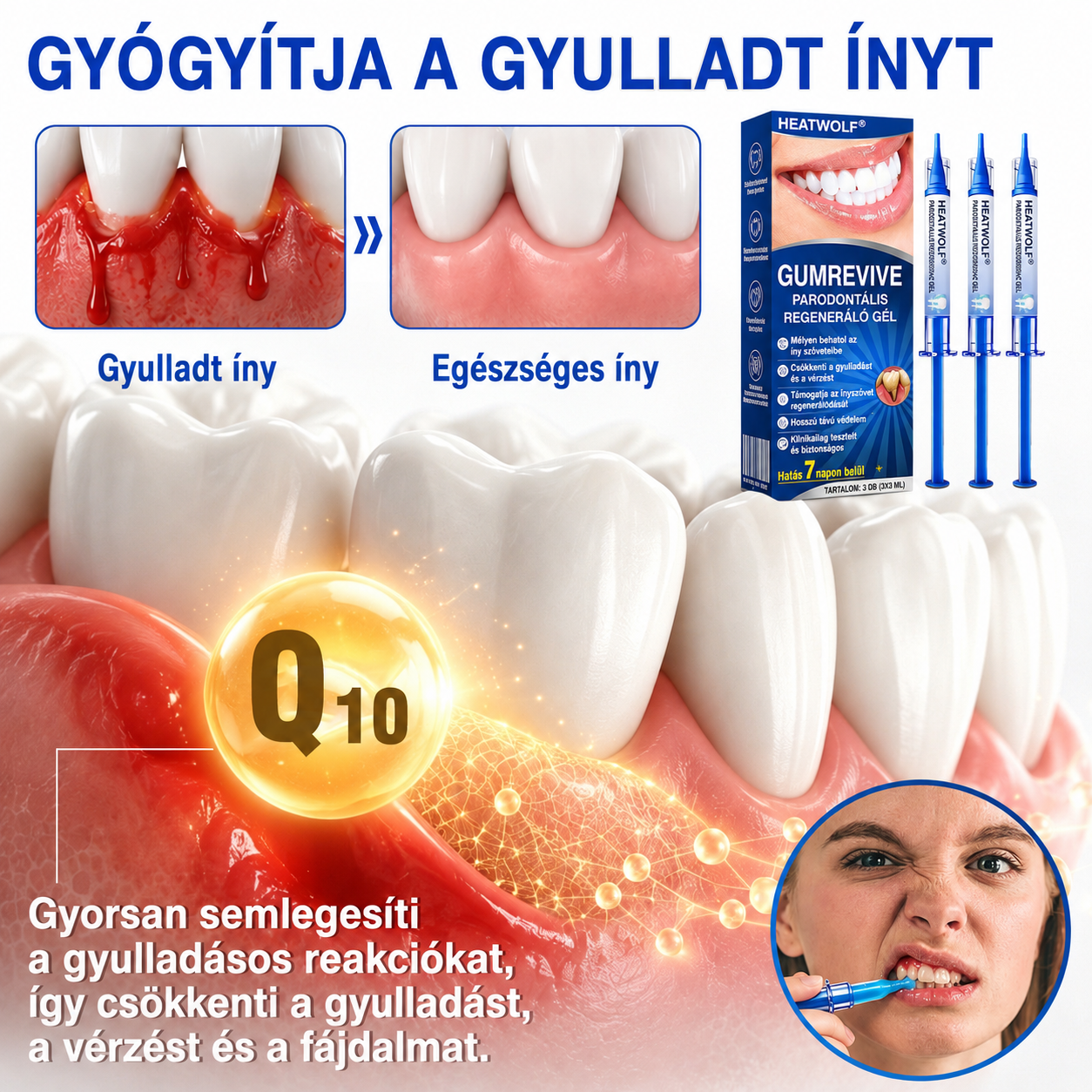 🚩 HEATWOLF® 🦷🥏GumRevive – Parodontális helyreállító gél👈