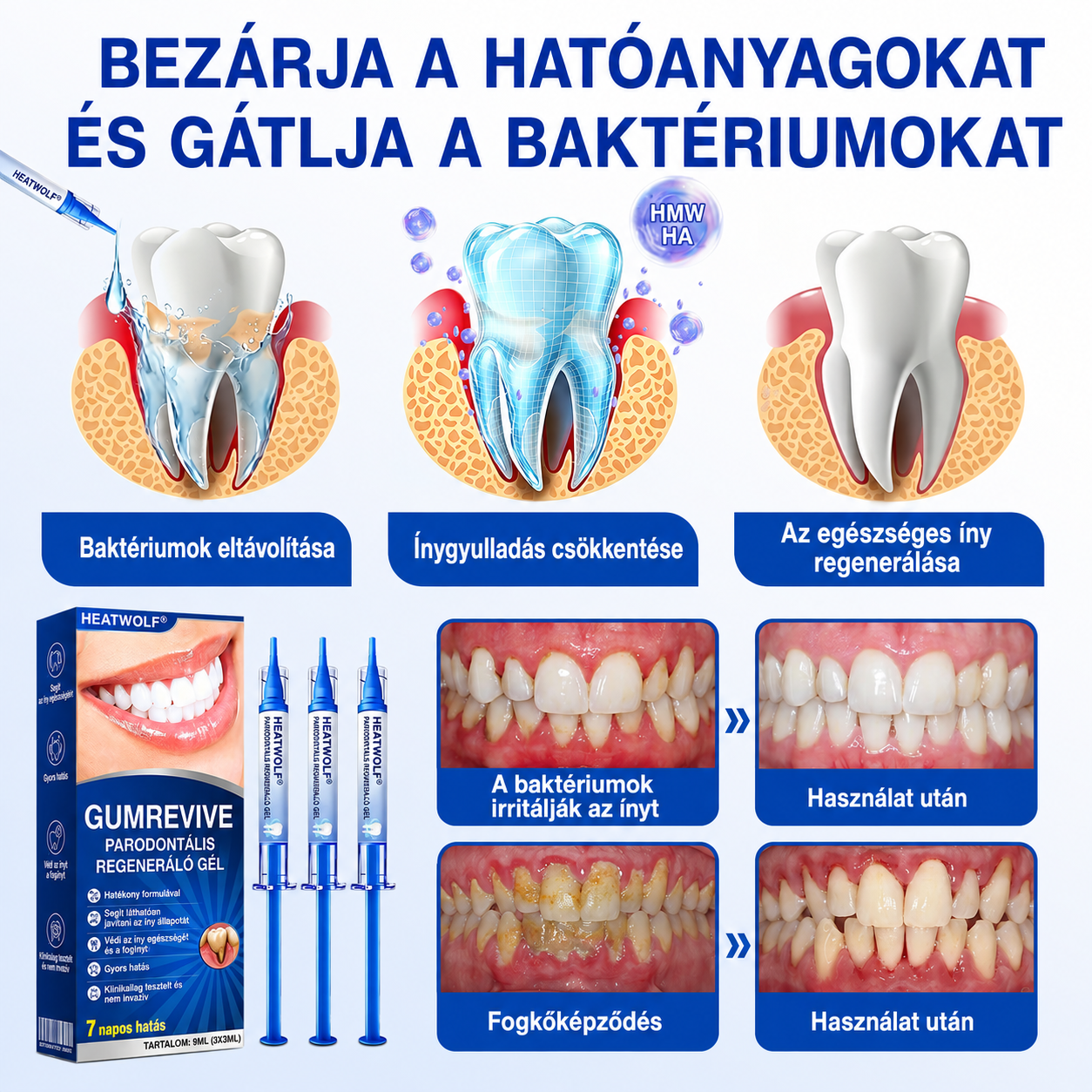 🚩 HEATWOLF® 🦷🥏GumRevive – Parodontális helyreállító gél👈