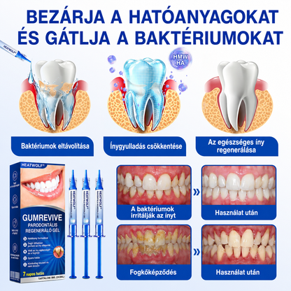 🚩 HEATWOLF® 🦷🥏GumRevive – Parodontális helyreállító gél👈