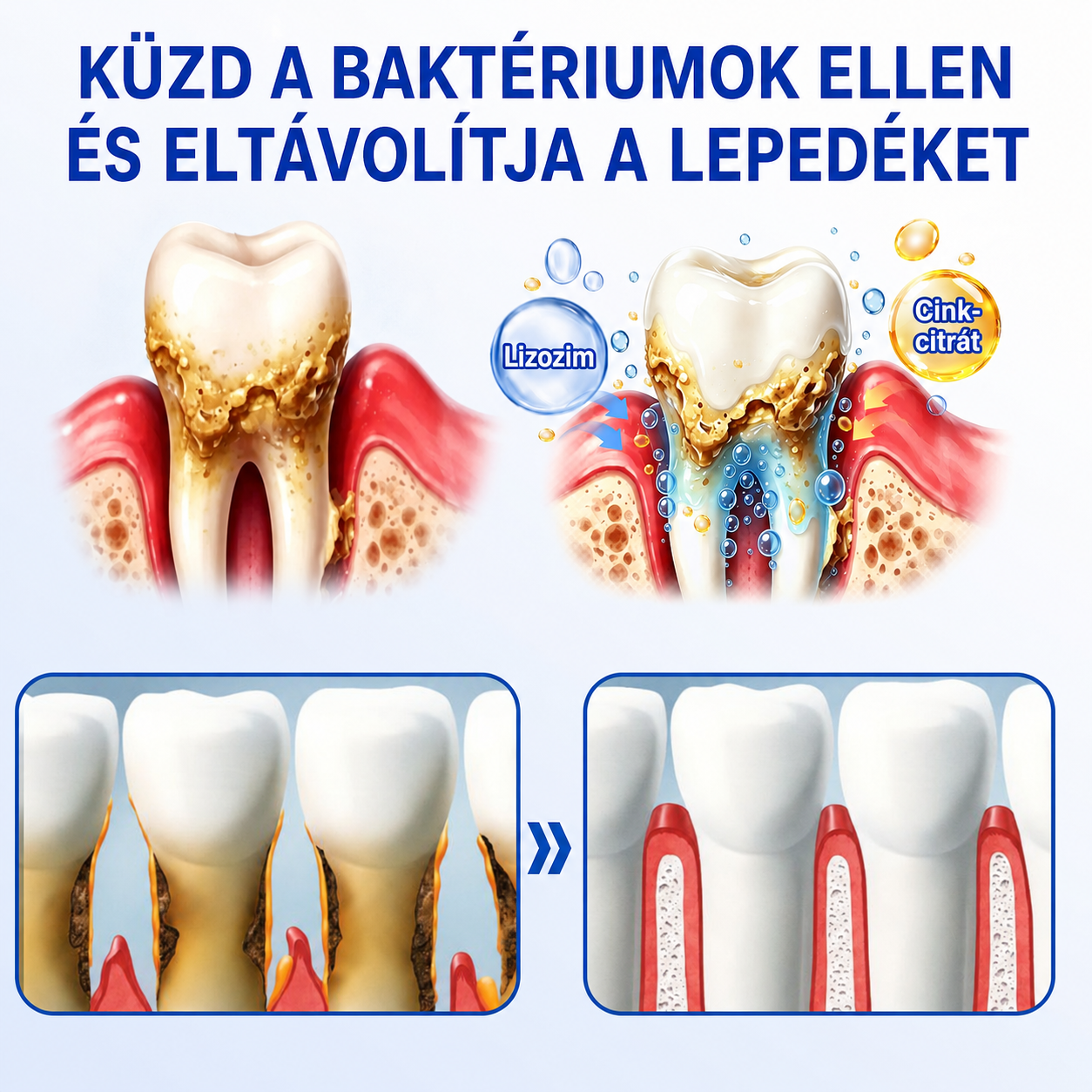 🚩 HEATWOLF® 🦷🥏GumRevive – Parodontális helyreállító gél👈