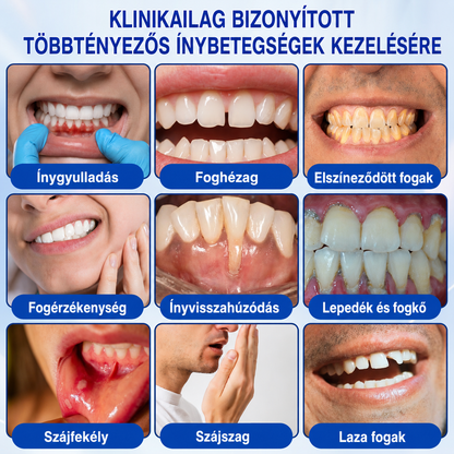 🚩 HEATWOLF® 🦷🥏GumRevive – Parodontális helyreállító gél👈